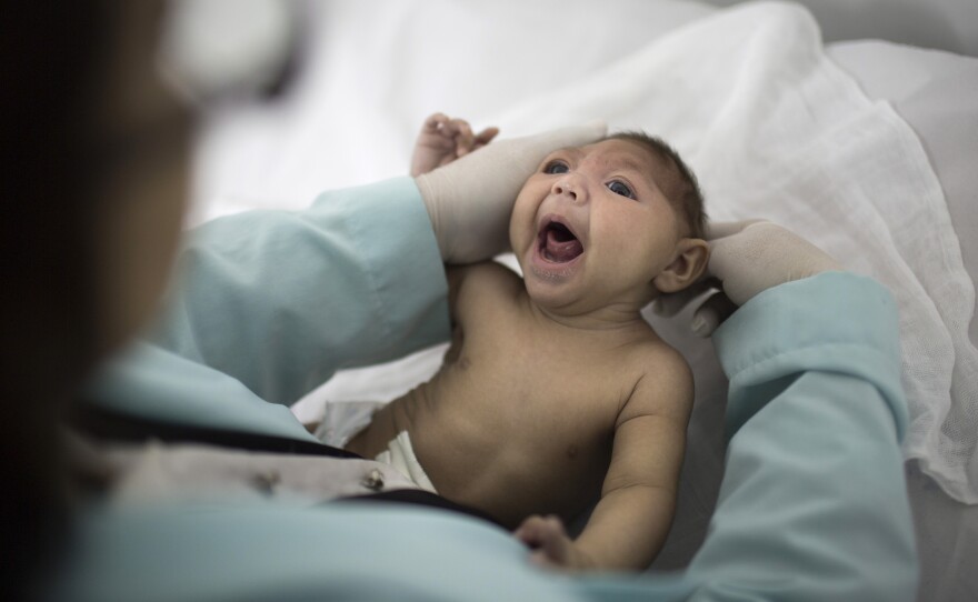 A baby born with microcephaly in Brazil is examined by a neurologist.