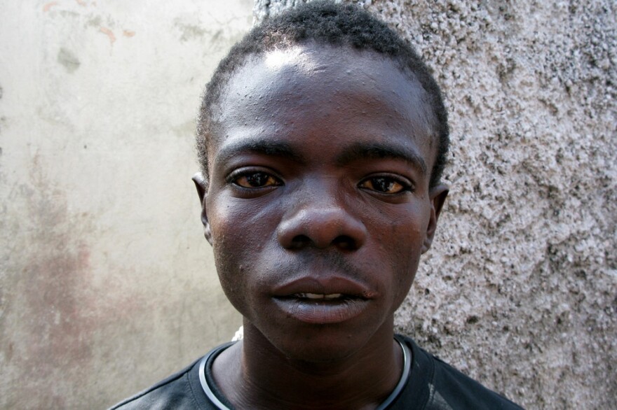 Edison Charles, 19, contracted cholera early in 2011 and spent six days in a clinic. He says the disease is all over the Port-au-Prince slum of Cite Soleil: "The cholera is like death; it's going from door to door."