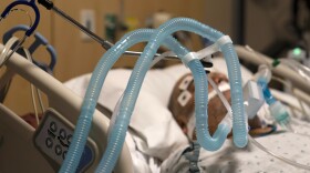 In this Nov. 19, 2020 file photo Ventilator tubes are attached a COVID-19 patient at Providence Holy Cross Medical Center in the Mission Hills section of Los Angeles.