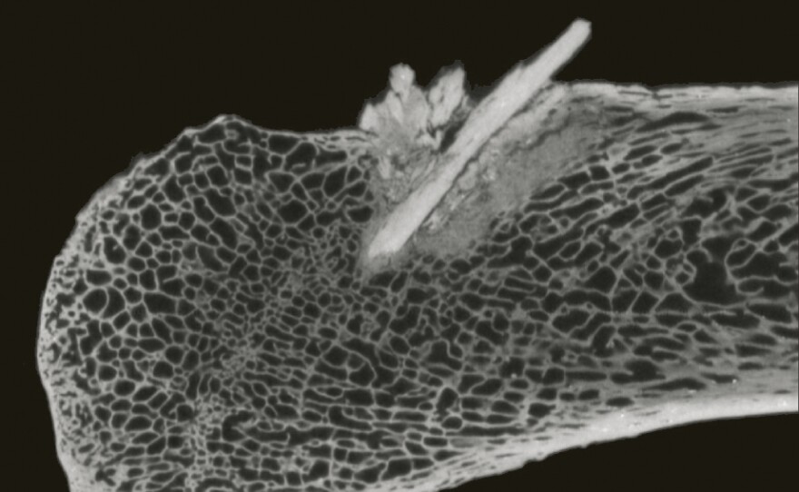 <p>This CT scan image shows a section of mastodon rib where researchers found a spear point lodged in the bone. The spear would have passed through more than 10 inches of hide, tissue and muscle.</p>