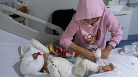 Ivana Likbiri, an 18-month-old Lebanese baby who got injured during an Israeli airstrike in southern Lebanon, is hospitalized at Geitaoui Hospital's burn unit, in Beirut, on Oct. 18.