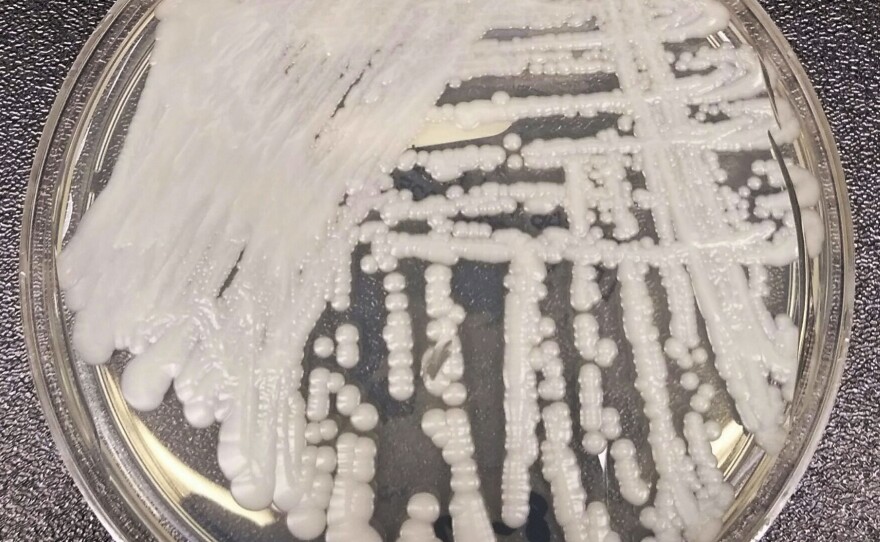 This is a strain of Candida auris cultured in a petri dish at a laboratory at the Centers for Disease Control and Prevention. It's a form of yeast that can harm humans — and is resistant to the most common antifungal drugs.