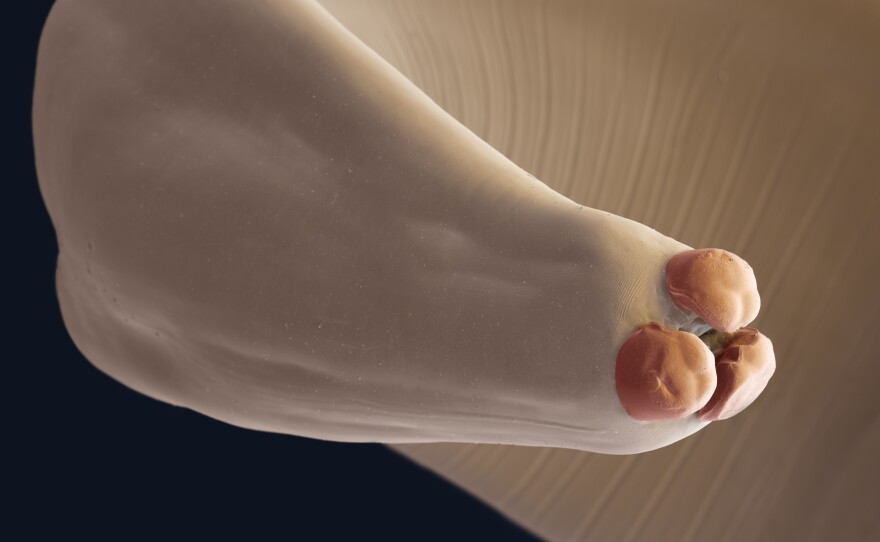 The giant roundworm, Ascaris lumbricoides, shows its three serrated lips.