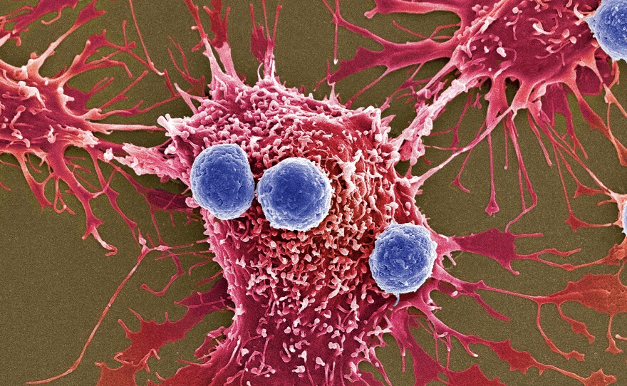 Scientists have created a treatment in which genetically modified T cells, shown in blue, can attack cancer cells, shown in red.