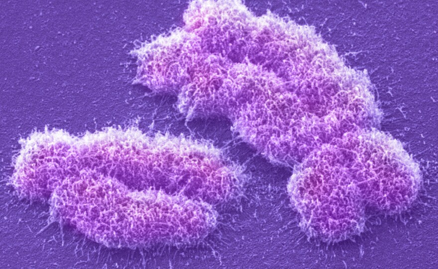 The human Y chromosome, left, holds the code for "maleness;" that's the X on the right.