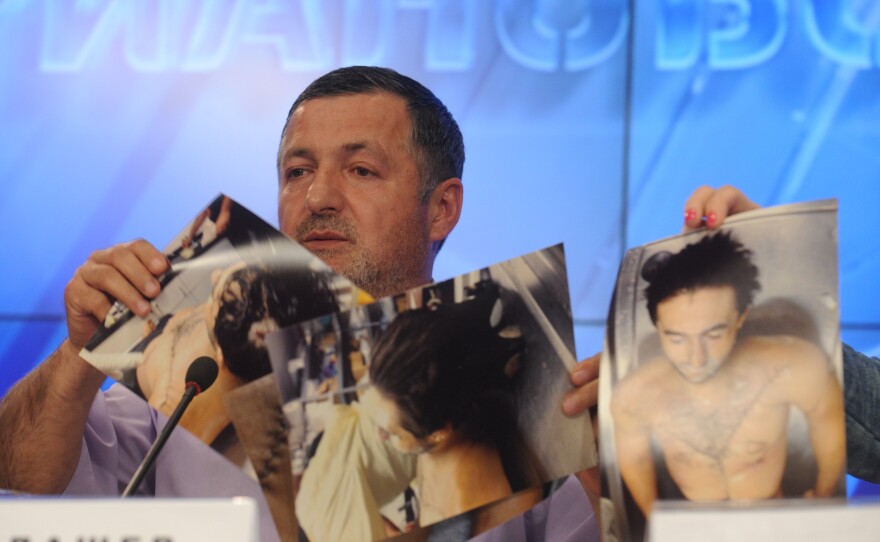 Abdul-Baki Todashev, father of Ibragim Todashev, shows pictures he says are of his son's bullet-riddled body, at a news conference in Moscow on Thursday.