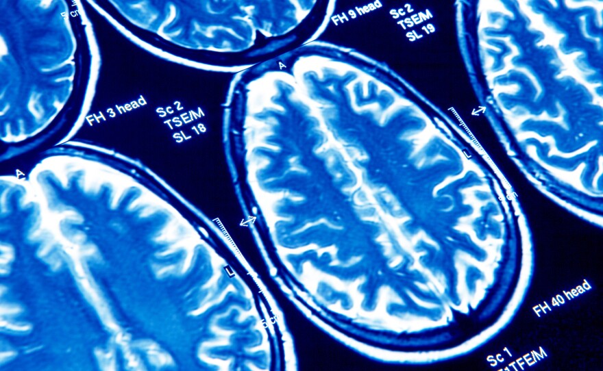 Most people who say they've had a concussion say they sought out medical care at the time.