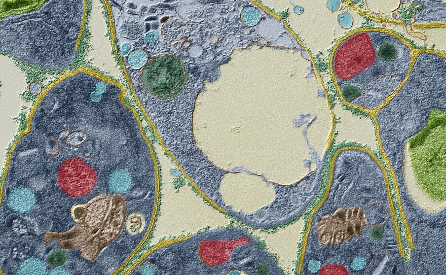 Toxoplasma gondii, a parasitic protozoan, that afflicts cats and other mammals. Acute toxoplasmosis produces flu-like symptoms and has been linked to behavioral changes in humans.