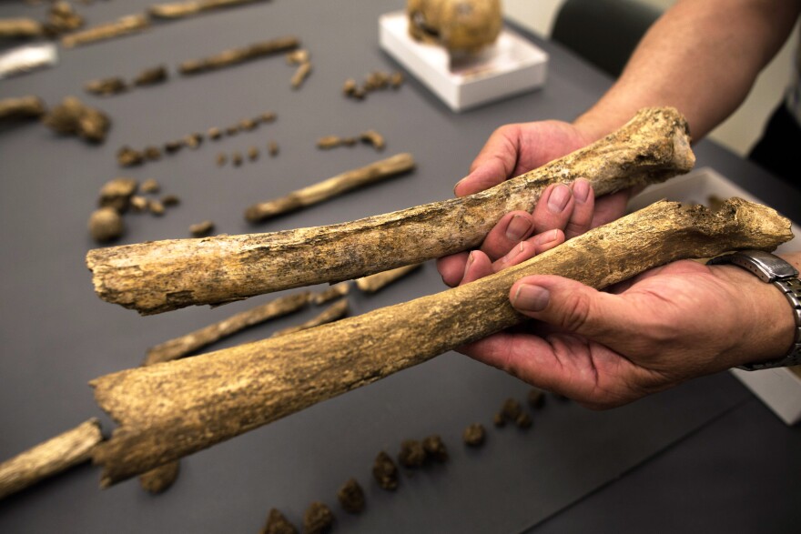 Owsley holds thigh bones from two different skeletons. The one above has a ridge that suggests the man may have had muscular legs — perhaps from riding horses.