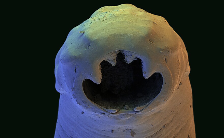 The Old World hookworm, Ancylostoma duodenale, an intestinal parasite. Adult worms feed on the human intestinal lining, leading to blood loss and anemia.