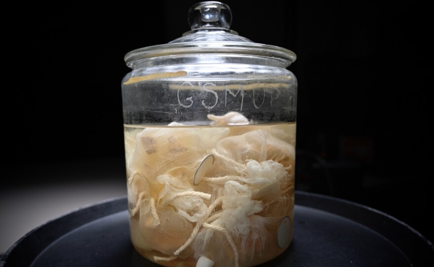 Einstein's brain (undated photo)