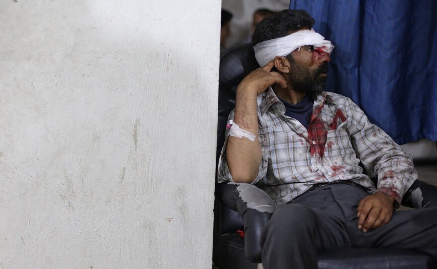 An injured man sits after being treated at a medical center following shelling in the city of Douma, Syria.