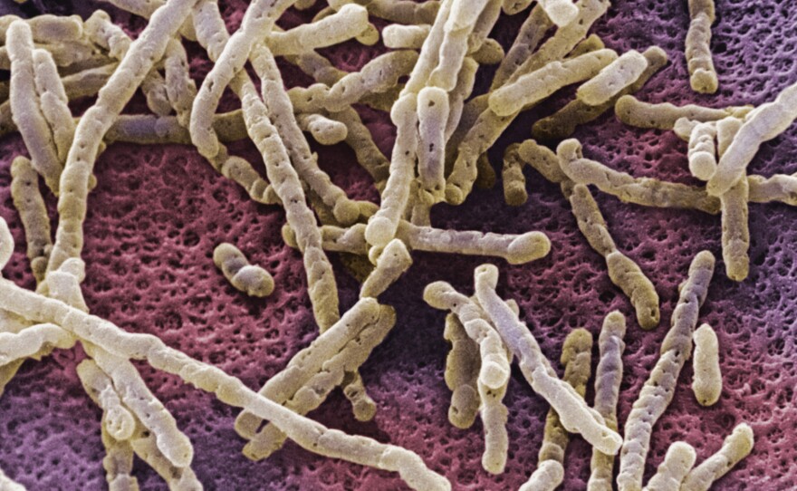An overgrowth of Clostridium difficile bacteria can inflame the colon with a life-threatening infection.