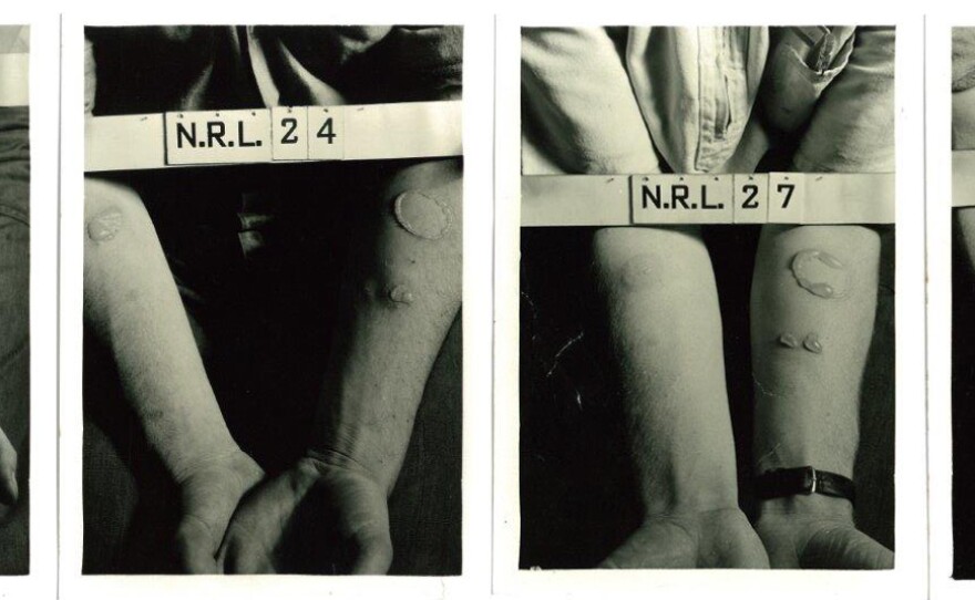Secret World War II Chemical Experiments Tested Troops By Race | KPBS ...