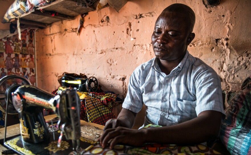 Gaby Ngabu Kasongo also has konzo. But his life has improved since he found a job as a tailor.