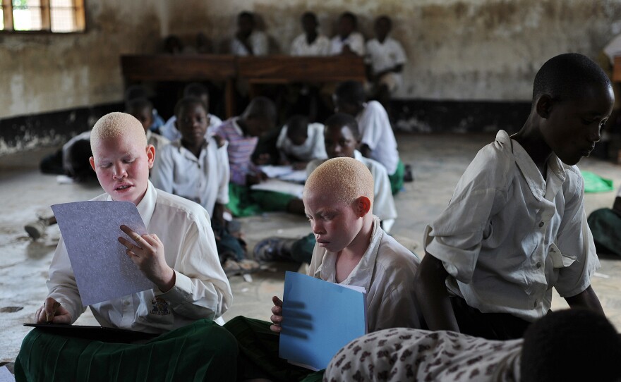 Children with albinism, a genetic condition that can cause vision problems, study at a school for the blind in Tanzania. Because albinos are often attacked, the school is a rare sanctuary.