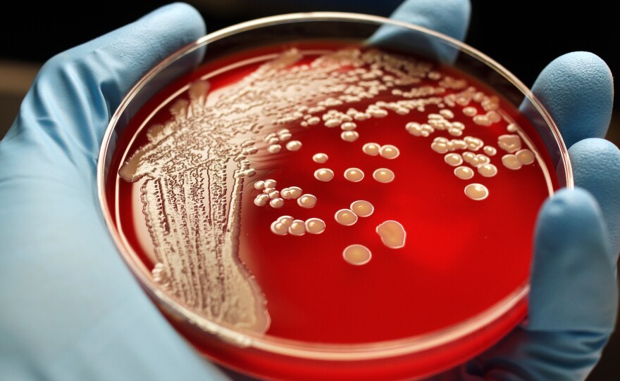 Scientists are exploring new drugs that can fight antibiotic-resistant bacteria such as MRSA.