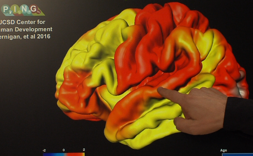 John Iversen points to the part of the brain cortex that processes sound, Nov. 30, 2017.