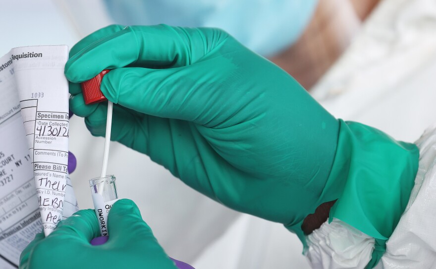 The majority of people likely infected with the omicron variant of COVID-19 were unaware, according to a study from a medical center in Los Angeles, Calif.