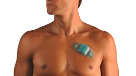 The ZIO Patch, made by iRhythm Technologies, is used to detect an irregular heart rates.