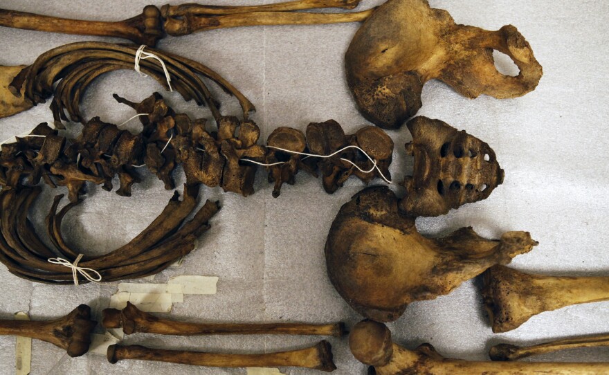 A human skeleton, part of the WM Bass Donated Skeletal Collection at the University of Tennessee, Knoxville.