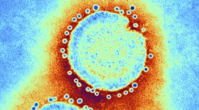 A sometimes lethal strain of H7N9 bird flu that has infected about 1,500 people in China doesn't spread easily among humans — yet. But research published Thursday suggests just a few genetic mutations might be enough to make it quite contagious.