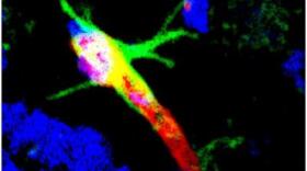 This undated image shows the peptide (in green) targeting to the brain blood vessel (red) in the hippocampus of the Alzheimer brain. Researchers at Sanford Burnham Prebys Medical Discovery Institute believe this peptide could help doctors detect Alzheimer's disease in its earliest stages.