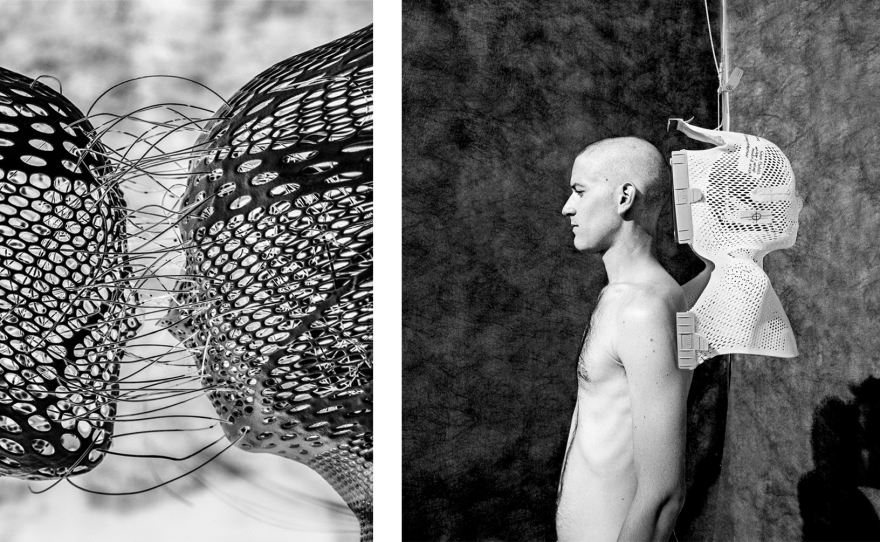 <strong>Left:</strong> <em data-stringify-type="italic">Witnesses</em>, 2021.<strong> Right</strong>: <em>Sharon's Radiation Mask</em>, 2020. This mask belonged to photographer Steven Katzman's wife, who died from skin cancer. After I built up the courage to ask him if I could photograph it, I shaved my head and had Marcia make this picture. She regrets getting rid of her own mask from treatment.