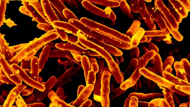 A scanning electron micrograph of Mycobacterium tuberculosis bacteria, which cause TB.
