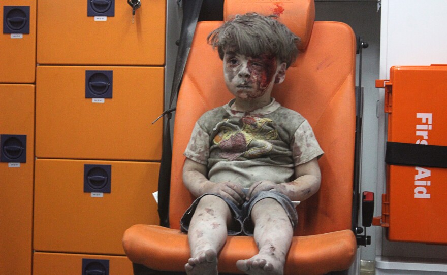 A 5-year-old boy, identified in news reports as Omran Daqneesh, sits in an ambulance after reportedly being pulled out of a building hit by an airstrike in Aleppo, Syria.