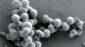 Craig Venter and his team planted a synthetic M. mycoides genome into these yeast cells.