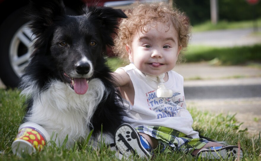 Kaiba Gionfriddo, who breathes with help from a splint created by a 3-D printer, plays with his family dog, Bandit, at his Youngstown, Ohio, home.