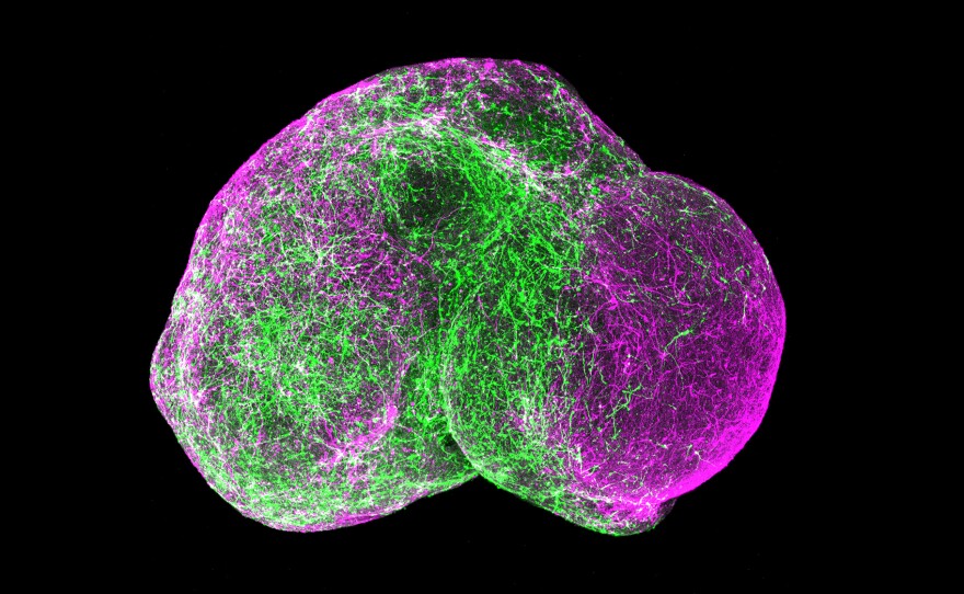 Scientists placed two clusters of cultured forebrain cells side by side (each cluster the size of a head of a pin). Within days, the "minibrains" had fused and particular neurons (in green) migrated from the left side to the right side, as subsets of cells do in a real brain.
