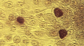 This 1975 microscope image made available by the Centers for Disease Control and Prevention shows Chlamydia trachomatis bacteria magnified 200X. 