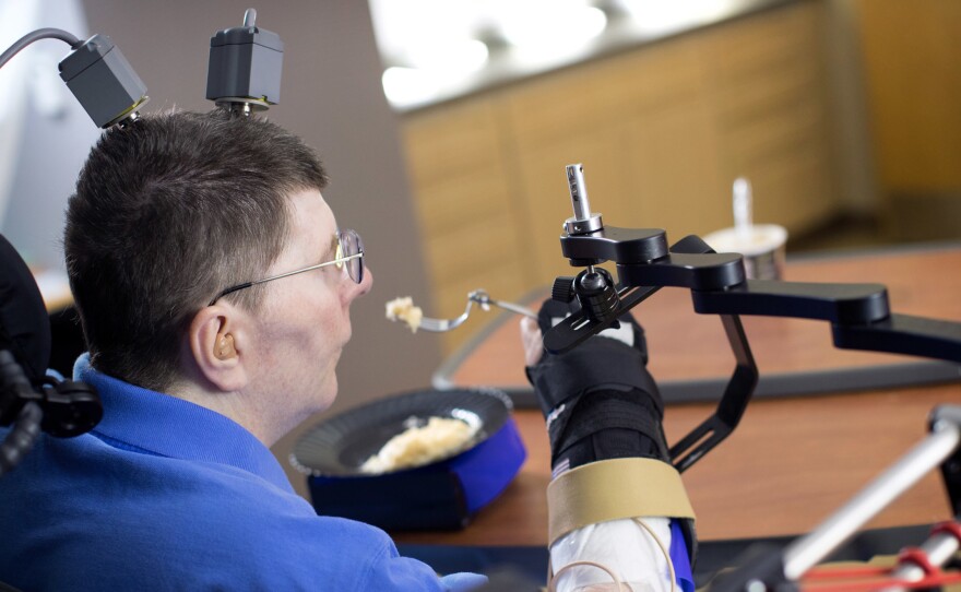 Bill Kochevar received an implanted brain-recording and muscle-stimulating system that allowed him to move limbs he hadn't been able to move in eight years.