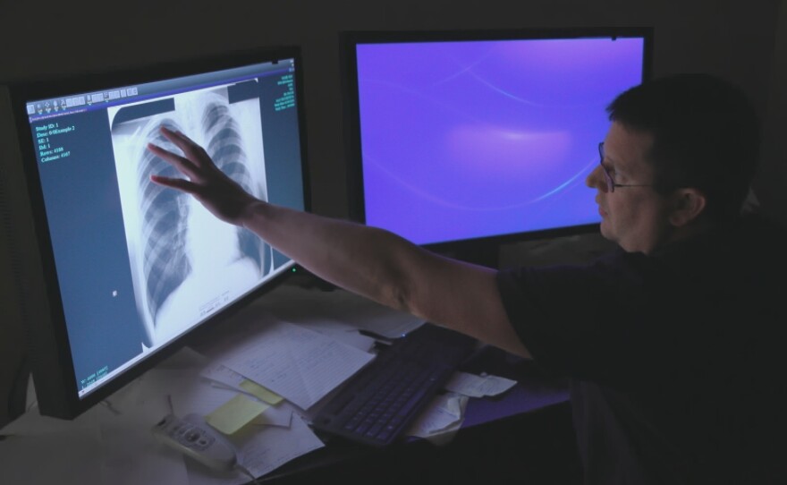 Dr. Brandon Crum reviews X-rays of coal miners with severe black lung disease at his clinic in Pikeville, Ky.