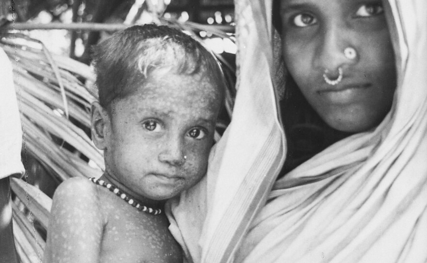 Rahima Banu, pictured with her mother in Bangladesh in 1975, is recorded as having the last known naturally-occurring case of the deadly form of smallpox.