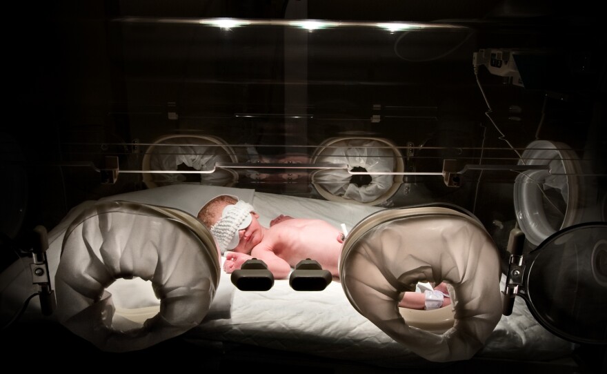 Stress, poverty and lack of  health care can lead to premature birth. Rates remain stubbornly high in many states.