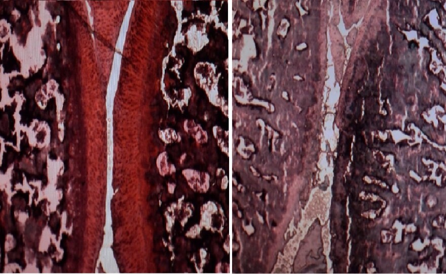 On the left is a cross-section of a knee from a rat with osteoarthritis that was treated using Salk scientists' protein therapy. On the right is a knee from a rat with osteoarthritis that was not treated. The red shows the amount of cartilage between the bones, February 4, 2020.
