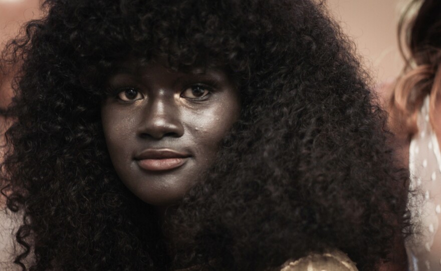 Khoudia Diop didn't realize her skin color was special until she left Senegal.