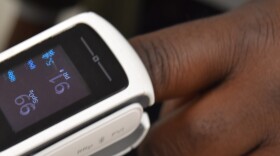 A pulse oximeter is worn by Brown University professor Kimani Toussaint. The devices have been shown in research to produce inaccurate results in dark-skinned people, and Toussaint's lab is developing technology that would be more accurate, regardless of skin tone.