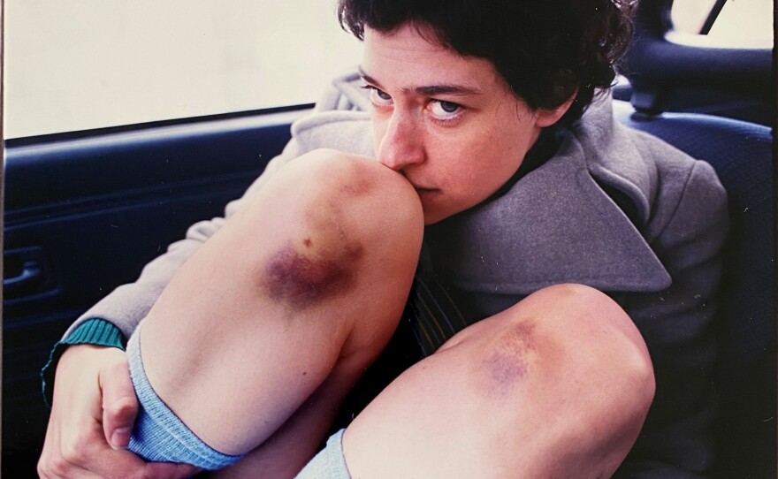 Peaches, on tour in Finland in 2001, displays the battle scars of her hyperphysical performances. "Every night I would jump to my knees," she said in a statement to NPR, "and every day I would say, 'Don't do that tonight.' But then I would do it, until I got so bruised from it I had to stop."