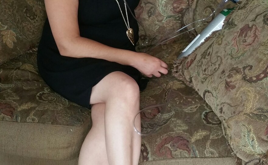 Stephanie Packer, 32, is terminally ill with the autoimmune disease scleroderma.