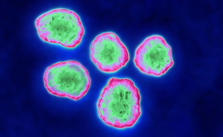 New research illuminates how the measles virus may suppress the immune system after an infection.