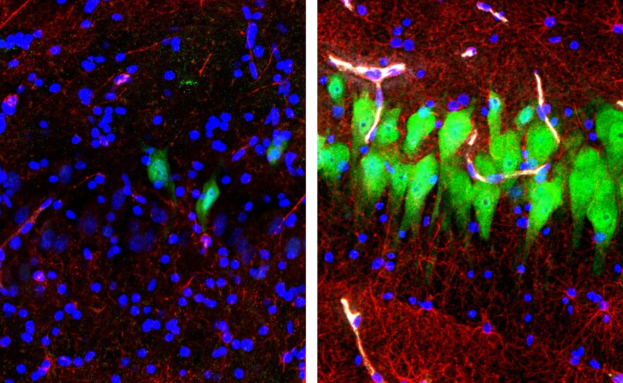 The image on the left shows the brains of pigs that were untreated for 10 hours after death, with neurons appearing as green, astrocytes as red and cell nuclei as blue. The image on the right shows cells in the same area of brains that, four hours after death, were hooked up to a system that the Yale University researchers call BrainEx.