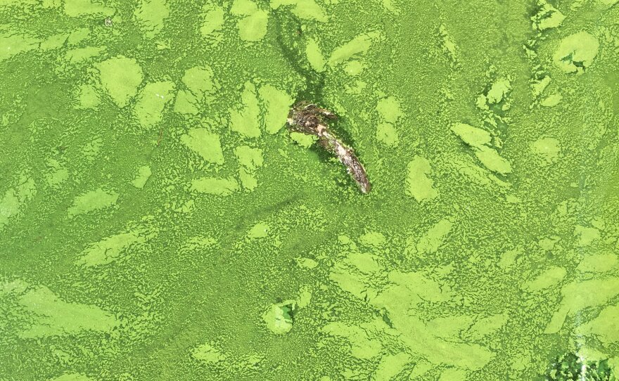 Officials found the toxin microcystin in the blue-green algae present at Discovery Bay, Calif. For people exposed to the toxin, symptoms include dizziness, rashes, fever, vomiting and in more unusual cases, numbness.