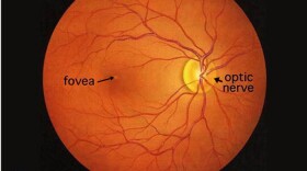Human retina as seen through an opthalmoscope.