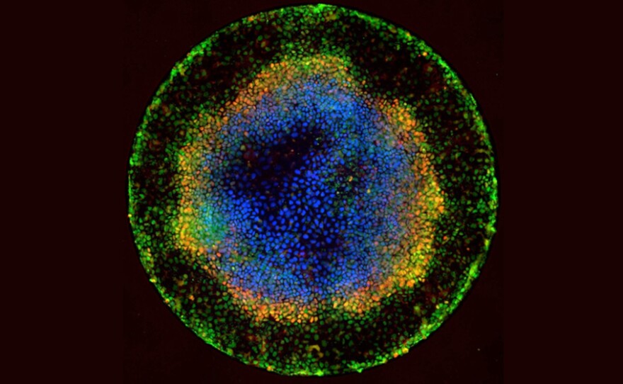Embryoids like this one are created from stem cells and resemble very primitive human embryos. Scientists are studying them in hopes of learning more about basic human biology and development.