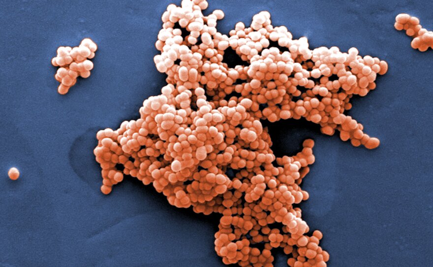 Streptococcus bacteria, like this strain, can be found in our guts.