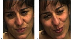 Which expression do you think shows real pain? The real expression of pain is image B on the right.